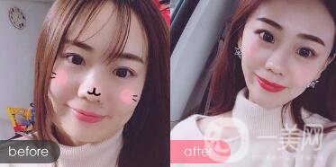 成都*價格 **果圖