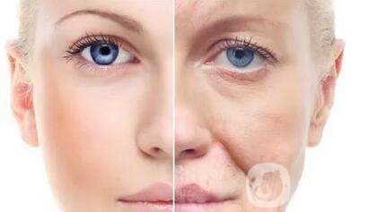 拉皮除皺的價格