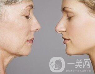 除皺的方式有哪些？