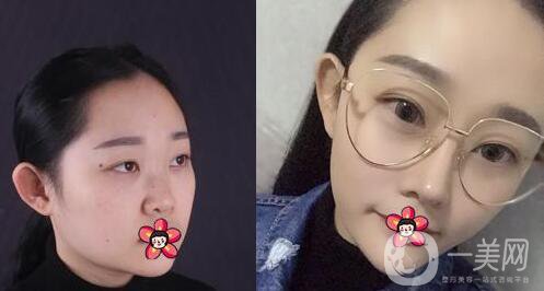 蔣小花醫(yī)生