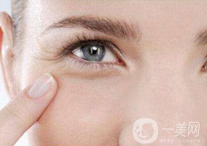祛除眼角魚(yú)尾紋