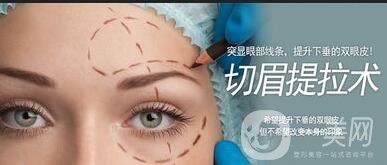 眉毛提升術(shù)