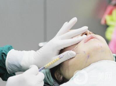 自體脂肪移植注意事項