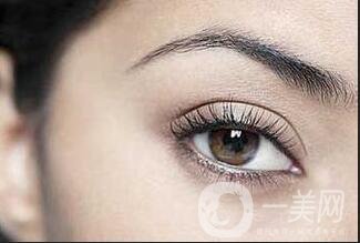 內(nèi)吸去眼袋價格