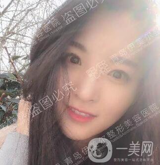 開眼角價(jià)格