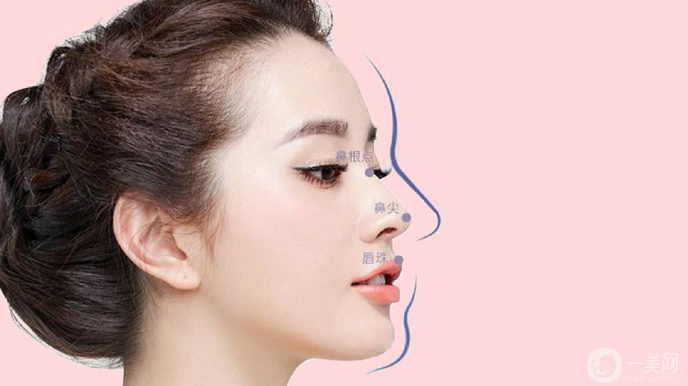 成都鼻翼縮小費用是多少呢