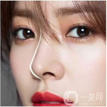 成都瑞蘭隆鼻多少錢呢