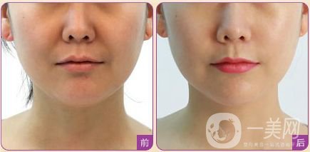 熱瑪吉多少錢(qián)呢