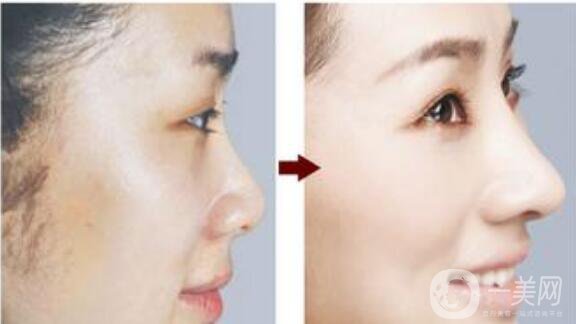 贛榆國(guó)泰整形醫(yī)院