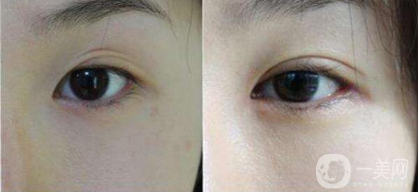 贛榆國(guó)泰整形醫(yī)院