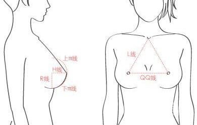 假體隆胸術(shù)有哪些特點(diǎn)？