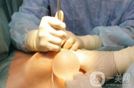 隆胸假體取出有沒有后遺癥？要怎么護(hù)理？