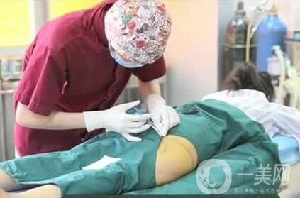 大腿抽脂多久恢復(fù)正常?恢復(fù)階段變化解說(shuō)