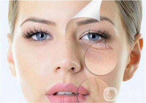 激光去眼袋的價(jià)格多少？要打幾次？