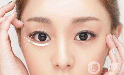 激光去眼袋的價(jià)格多少？要打幾次？