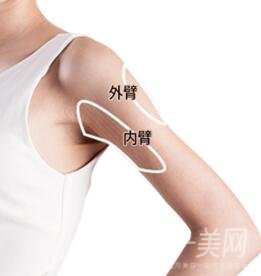 上臂吸脂多久恢復(fù)？需要住院嗎？