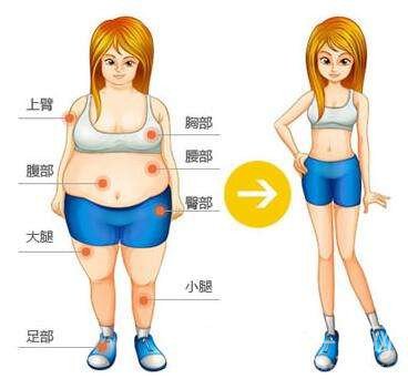 全身吸脂減肥好多錢？手術(shù)價(jià)格多少？