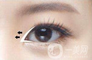 開眼角眼睛會(huì)變大嗎？眼睛會(huì)變長(zhǎng)嗎？