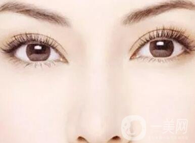 拉線雙眼皮貼的危害，小心你的眼皮變松弛!