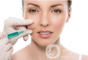 面部抽脂多久可以消腫恢復？*小妙招~