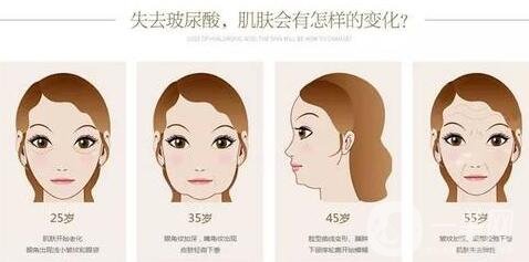 注射玻尿酸危害大嗎?有沒有毀容的風(fēng)險?