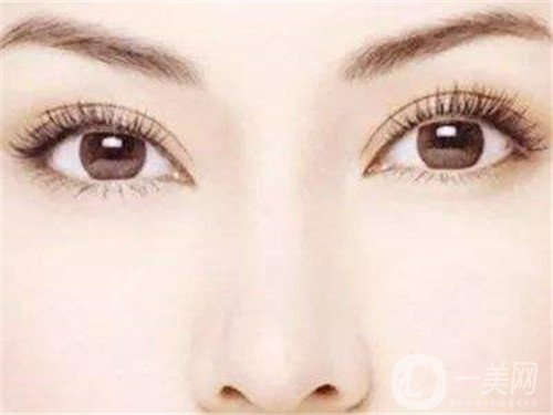 假體隆鼻多久完全消腫？怎么加速消腫呢？