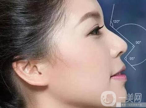 *多久才能笑自然?恢復(fù)期要多久?