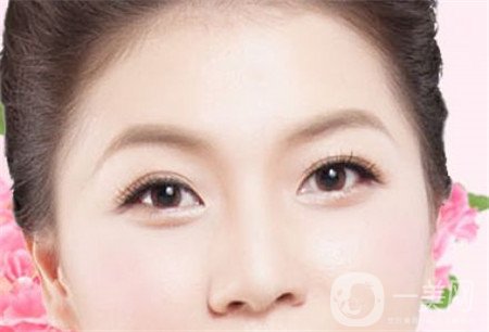 韓式開眼角多少錢？普遍價(jià)位是多少？