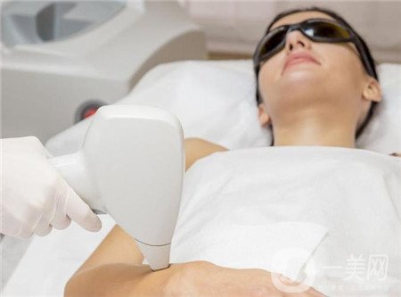 激光脫毛好嗎？有副作用嗎？