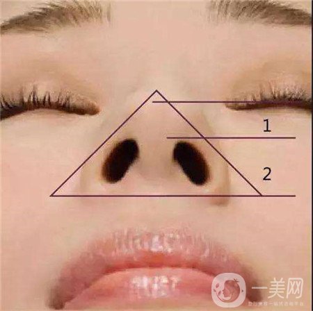 哪些人不適合硅膠隆鼻？禁忌人群是哪些？