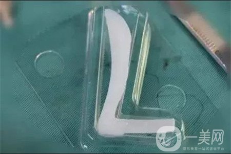 膨體隆鼻缺點是什么？優(yōu)點有哪些？