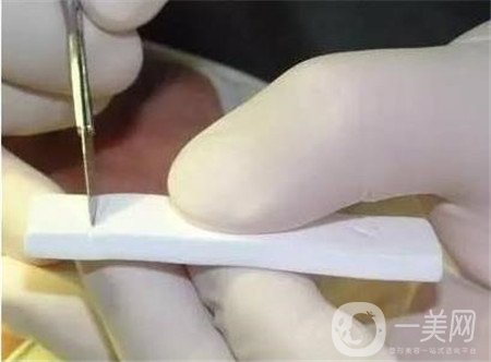 膨體隆鼻術(shù)后注意事項(xiàng)有哪些？需要忌口嗎？