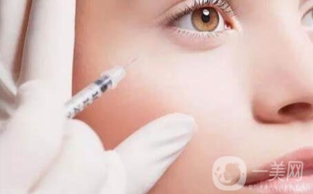 自體脂肪填充全臉術