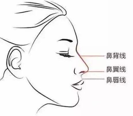 肋骨隆鼻多久可以修復(fù)?修復(fù)用什么材料?