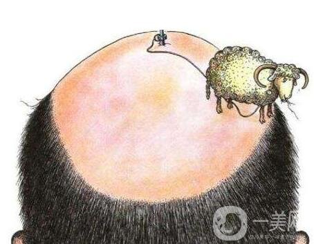 廣州種植頭發(fā)要多少錢?影響因素說明