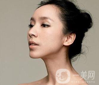 請問假體隆鼻手術(shù)需要多少錢呢？