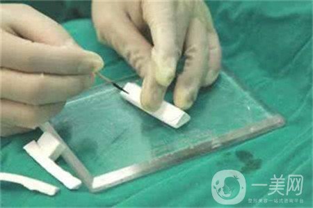 假體隆鼻術(shù)價(jià)格大概是多少？求告知