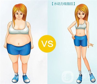 腰腹吸脂有積液怎么辦？不排出對(duì)身體有影響嗎？