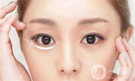 眼部提升手術(shù)怎么做？多久恢復(fù)？