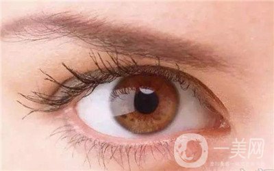  眼部整形費(fèi)用貴嗎？怎么收費(fèi)區(qū)別那么大？