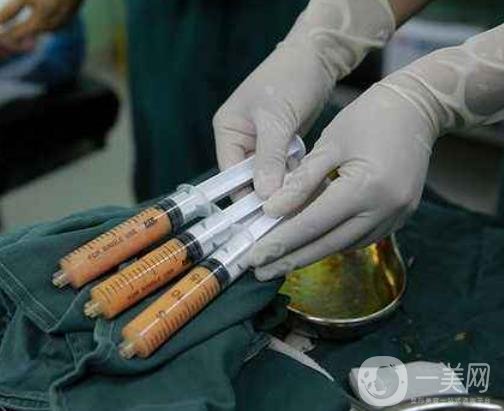 腰部吸脂的費(fèi)用大概多少錢？術(shù)后真的能瘦嗎？