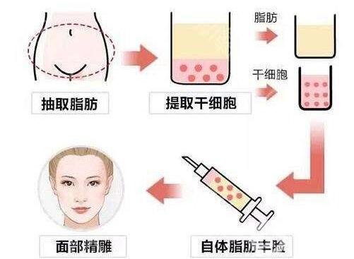 自體脂肪填充的淤青后有黑印子怎么辦?