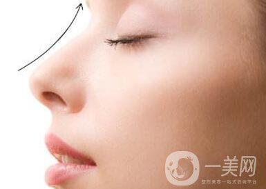 北京整容墊鼻梁多少錢？附隆鼻價(jià)格明細(xì)一覽表