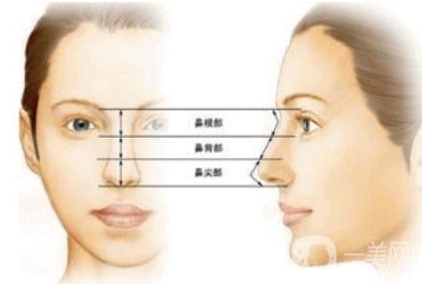 北京朝天鼻整容多少錢?具體怎么改良？