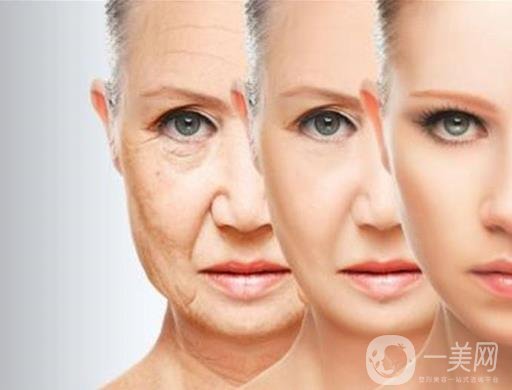 下筋膜懸吊祛皺術怎么操作的？*果嗎？