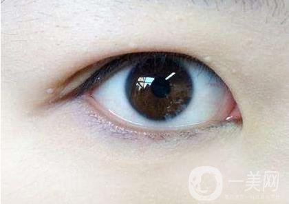 內(nèi)雙怎么變外雙？能貼雙眼皮貼嗎？