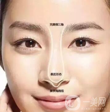 隆鼻手術(shù)怎么做？操作過(guò)程解析