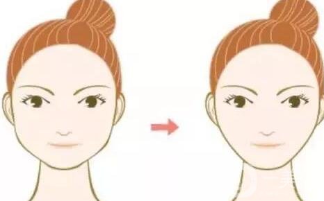 咬肌切除手術和*信息介紹些?