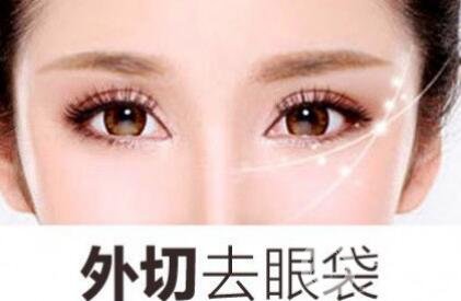 外切去眼袋后恢復期應該注意什么?