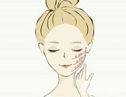 下頜角手術(shù)術(shù)后護(hù)理要注意哪些？